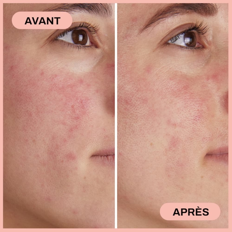 Sérum Apaisant & Protecteur au CBD 1% & Chanvre 10%