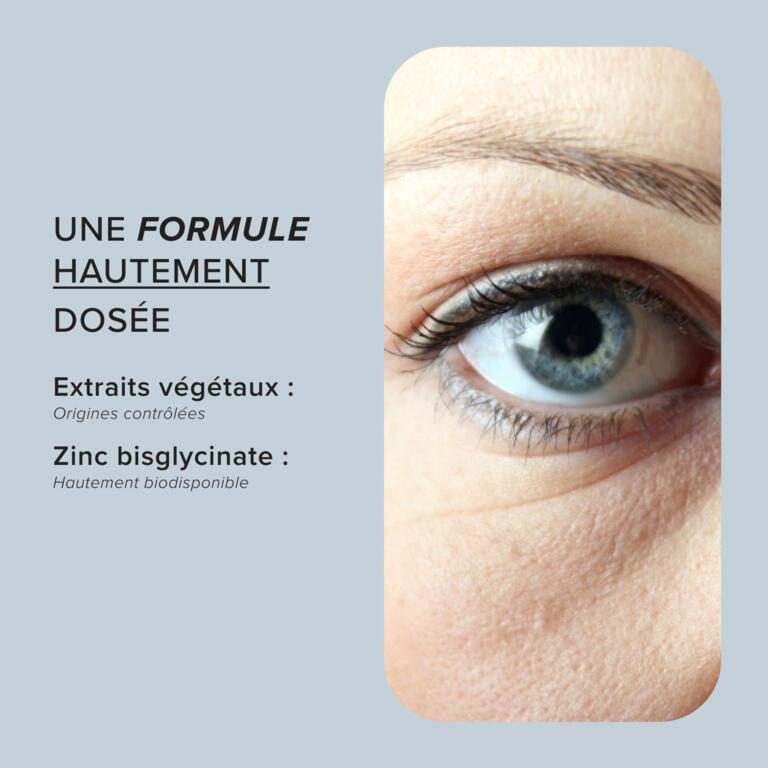 Complexe OptiConfort