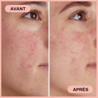 Sérum Apaisant & Protecteur au CBD 1% & Chanvre 10%